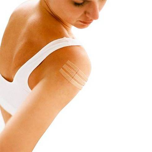 NEXCARE STERI STRIP 2 UN